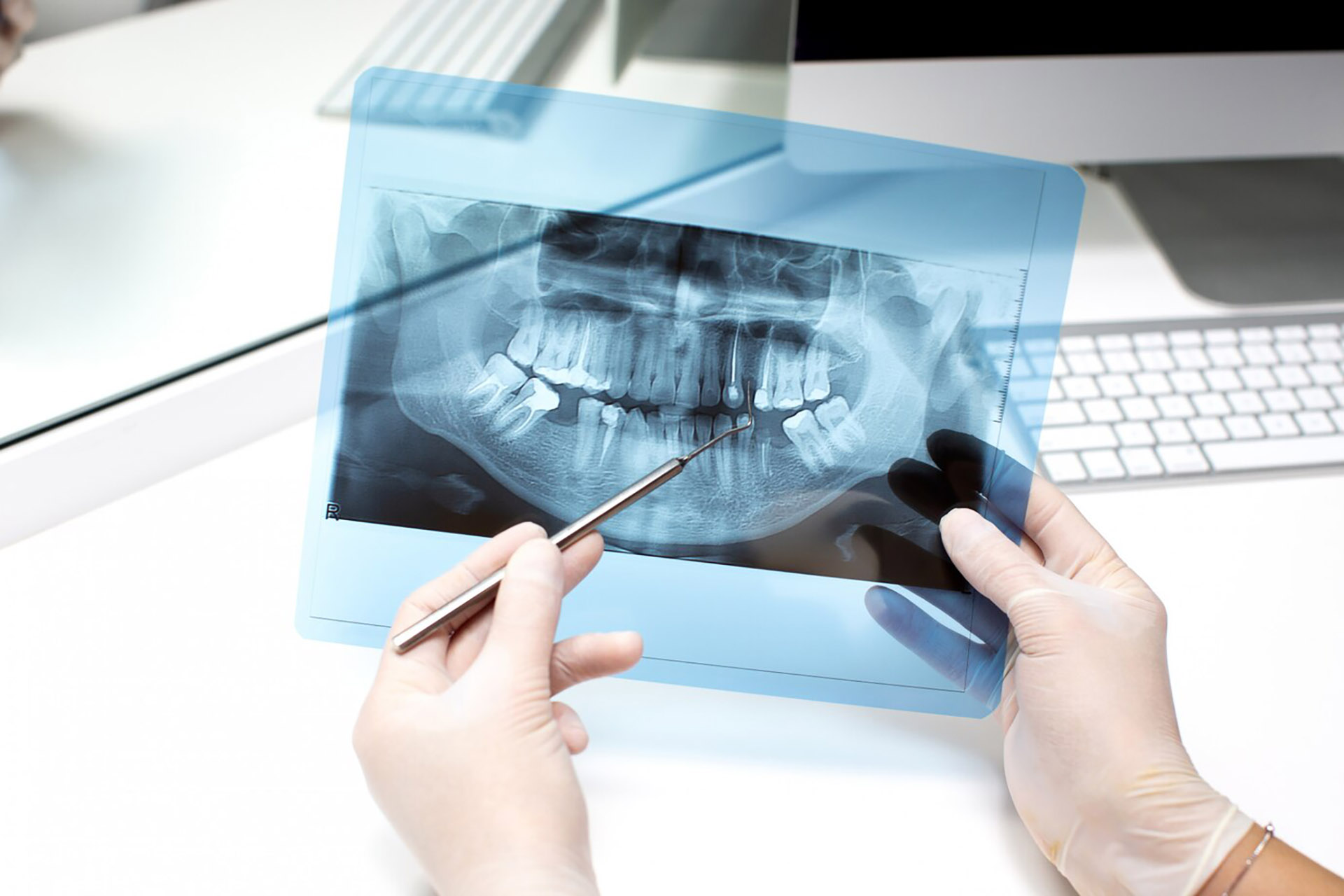 dentist-analyzes-x-ray-photo_140725-7685